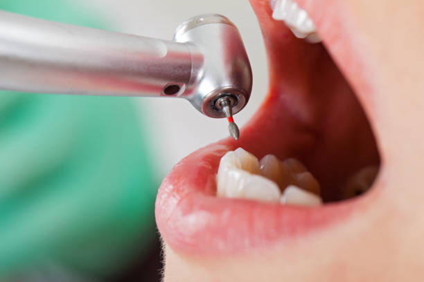 Best Urgent Dental Care  in Desert View Highlands, CA